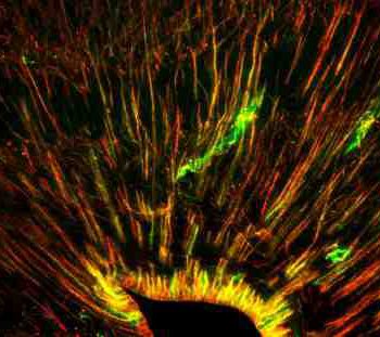 کشف نوعی سلول بنیادی که می تواند سلول های مغزی را تولید کند